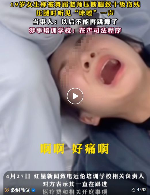 十级伤残!又一孩子被踩断腿这种兴趣班别乱报爸妈长点心吧(图2)