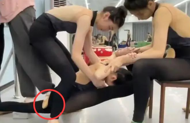 十级伤残!又一孩子被踩断腿这种兴趣班别乱报爸妈长点心吧(图5)