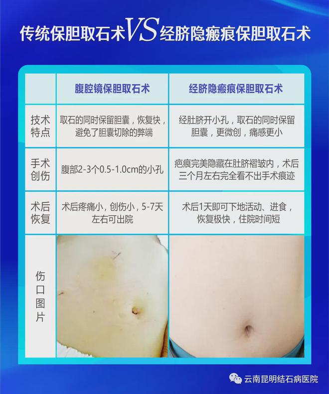 普洱保胆医院-云南普洱保胆专家揭秘:这个坏习惯让他痛不欲生!(图3)