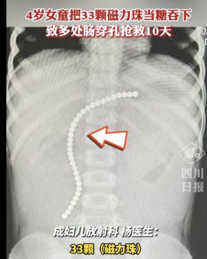 急诊医生：4个危险又常见的玩具孩子再喜欢也别给过年也不行(图4)