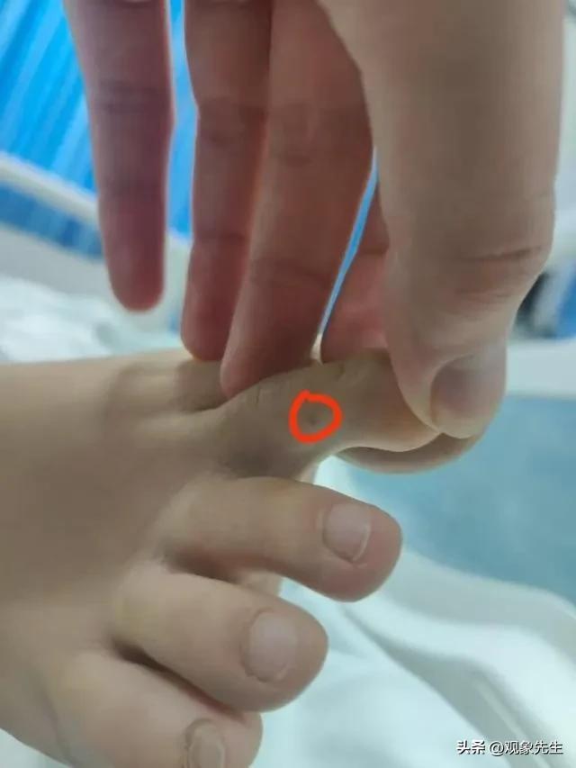 女子三亚被咬身亡后续：她励志漂亮卫健委介入男友还原经过！(图3)