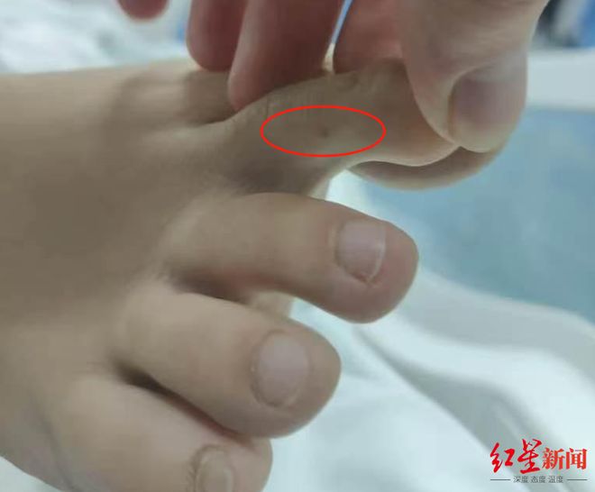 介入调查“27岁女子三亚旅游疑被不明物咬伤身亡”事件家属：未来有考虑尸检(图1)