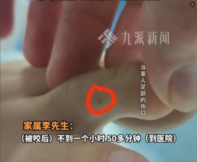 广东男子散步被毒蛇咬伤淡定拍照去医院网友：三亚女孩死真冤(图11)