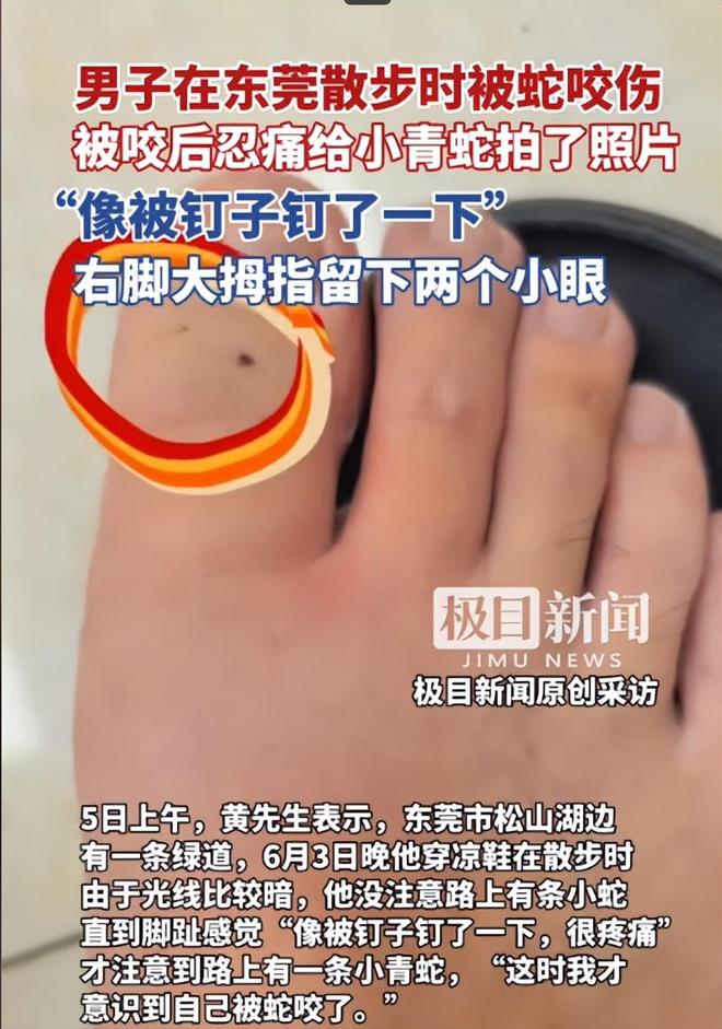 广东男子散步被毒蛇咬伤淡定拍照去医院网友：三亚女孩死真冤(图3)