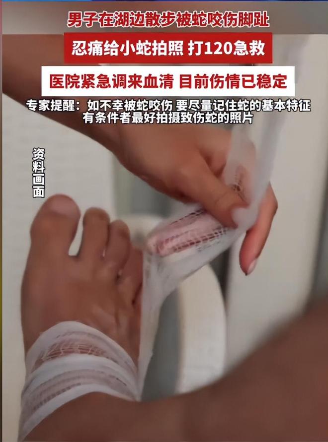 广东男子散步被毒蛇咬伤淡定拍照去医院网友：三亚女孩死真冤(图6)