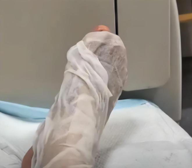 广东男子散步被毒蛇咬伤淡定拍照去医院网友：三亚女孩死真冤(图9)